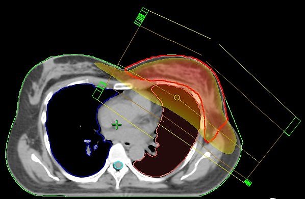 Stehfeldtechnik (Foto: Südharz Klinikum) Stehfeldtechnik (Foto: Südharz Klinikum)